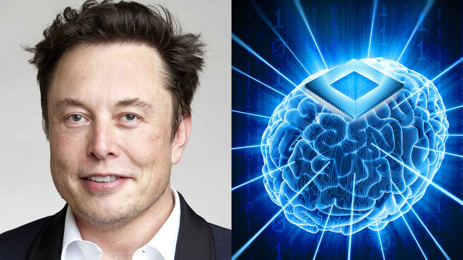 Elon Musk’s update on 2nd Neuralink patient: There will be millions more in 10 years