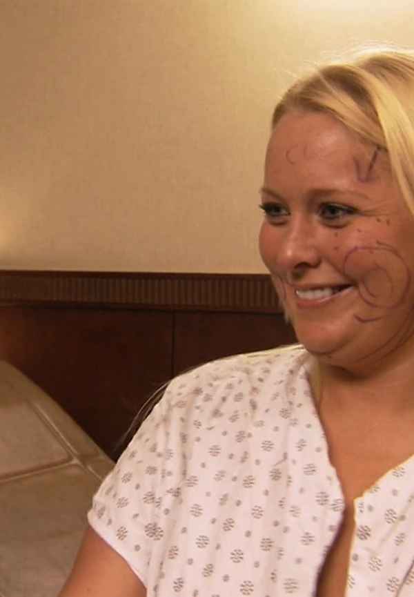 Bridalplasty Poster 3