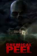 Chemical Peel Poster 6