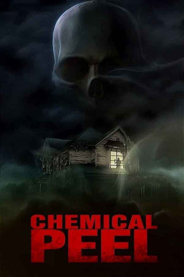 Chemical Peel Poster 6
