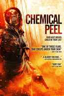 Chemical Peel Poster 3