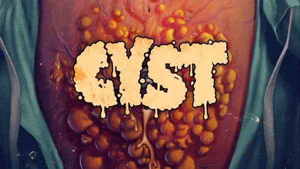 Cyst Poster 3