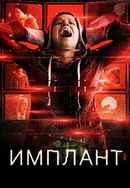 Implanted Poster 7