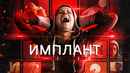 Implanted Poster 1