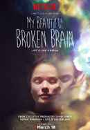 My Beautiful Broken Brain Poster 4