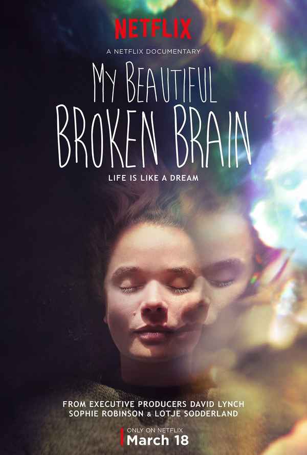 My Beautiful Broken Brain Poster 1