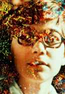 Pigment-Dispersion Syndrome Poster 2