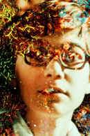 Pigment-Dispersion Syndrome Poster 1