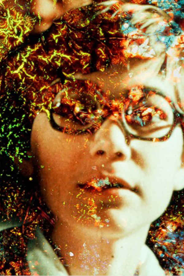 Pigment-Dispersion Syndrome Poster 1