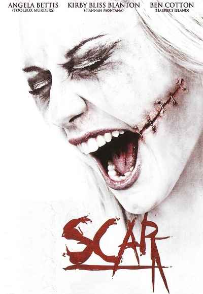 Scar