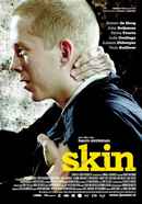 Skin Poster 5
