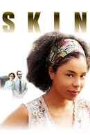 Skin Poster 1