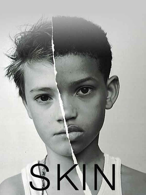 SKIN Poster 7