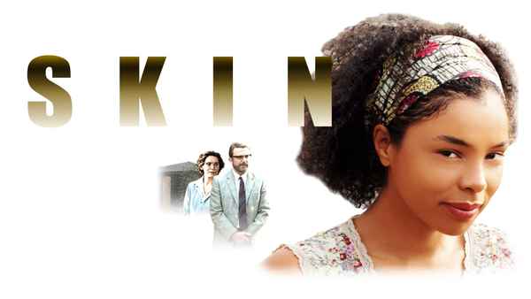 Skin Poster 6