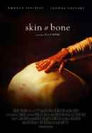 Skin & Bone Poster 5