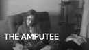 The Amputee Poster 6