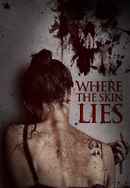 Where the Skin Lies Poster 6