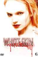 White Skin Poster 3