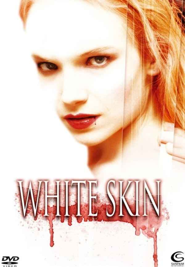 White Skin Poster 7