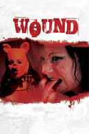 Wound Poster 1
