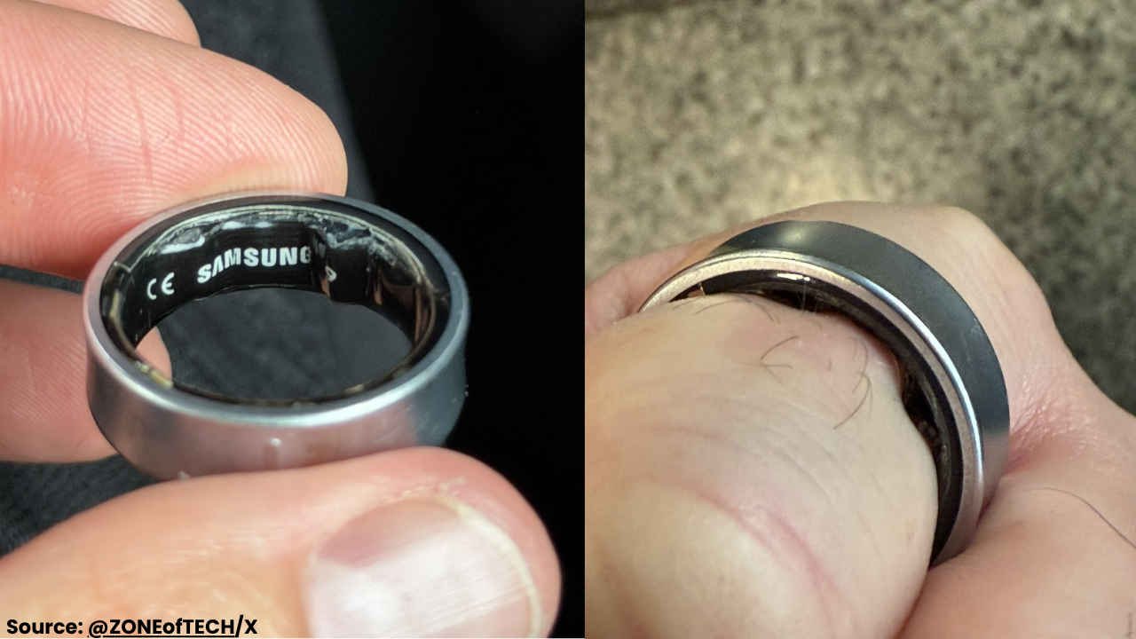 YouTuber shares alarming photos after Samsung Galaxy Ring swells on finger