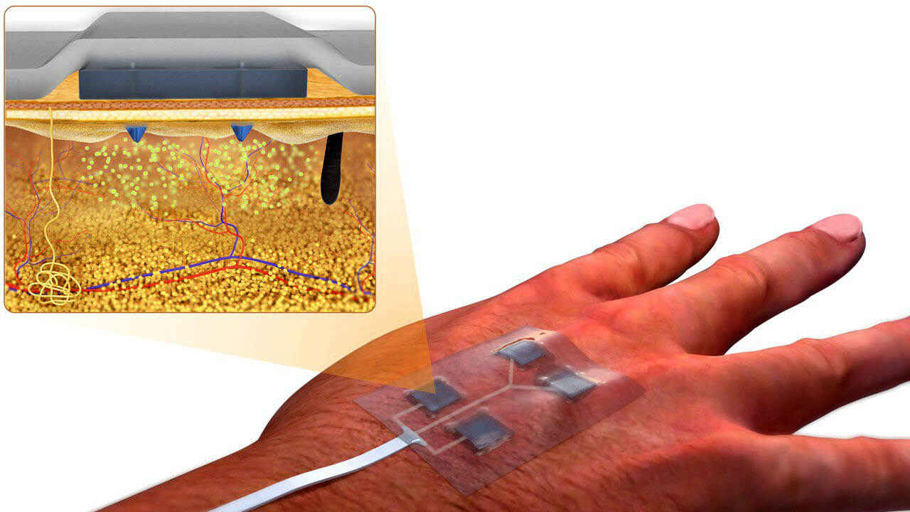Researchers develop ‘smart’ wirelessly-controlled bandage that could be helpful for diabetic patients