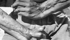 .. तर असा होता परमाणु हत्यारांचा इतिहास आणि कार्य